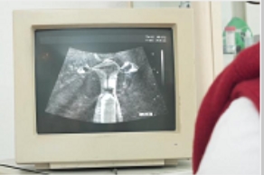 带老婆去医院做B超-B超仪上竟然看到了有东西在神秘处